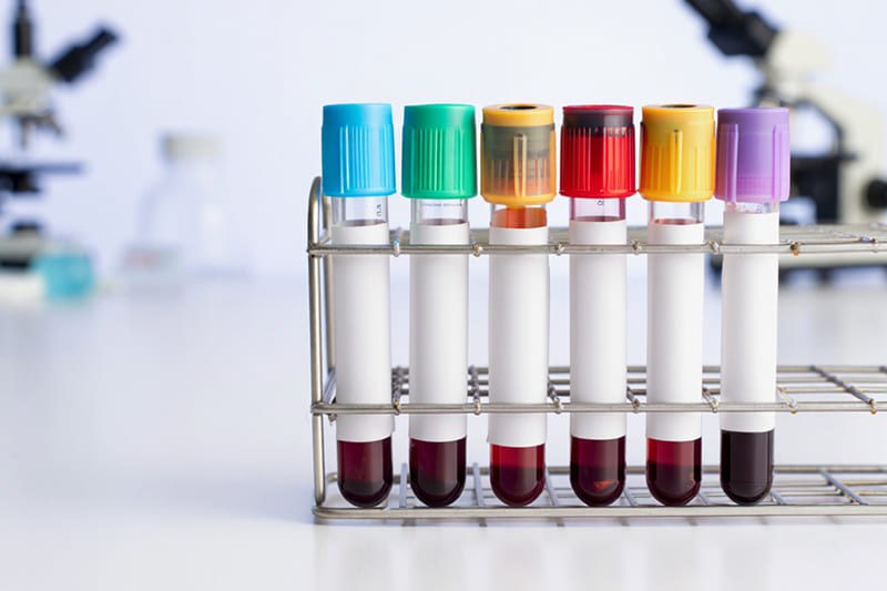 Лабораторные пробирки для анализа крови с цветными крышками в штативе для тестирования